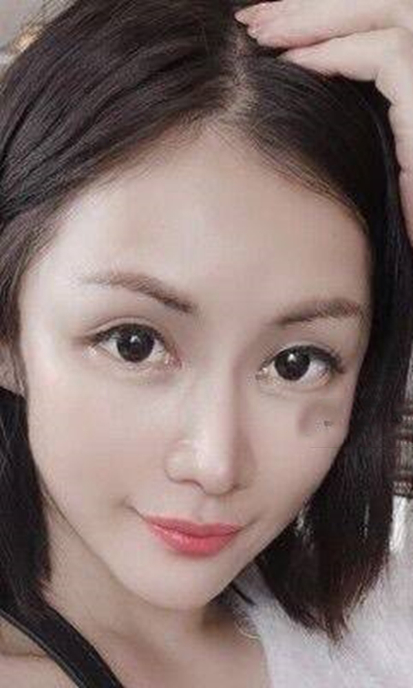 白领一冰古方疗