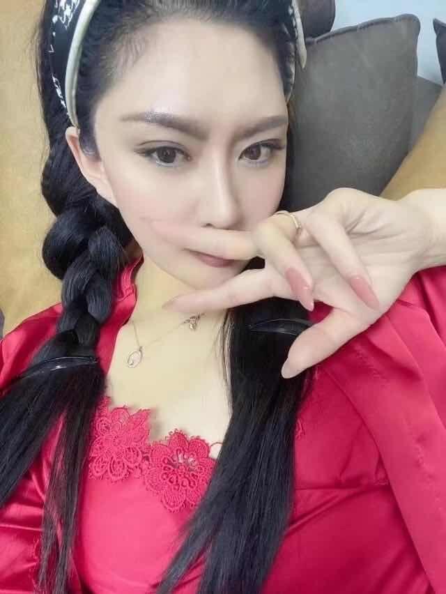 太原整容蛇精脸的少妇